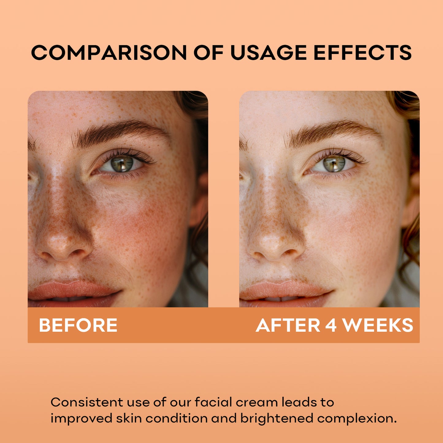 SYABO Niacinamide Face Cream, Anti-aging Face Moisturizer, Dilute Acne Marks, Even Skin Tone, Increase Skin Luster - All Skin Types 1.76 Fl. oz/ 50ml Skincare Lighten Skin Repair Moisture Hydrate Hydrating Moisturizing